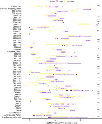 Upregulation of CCNB2 and Its Perspective Mechanisms in Cerebral Ischemic Stroke and All Subtypes of Lung Cancer: A Comprehensive Study